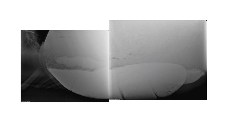 A radiograph showing a horse presenting with acute colic with evident moderate sand accumulation