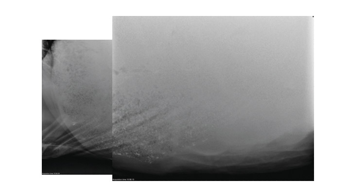 A radiograph demonstrating the abdomen of a horse's stomach after recovering from sand colic